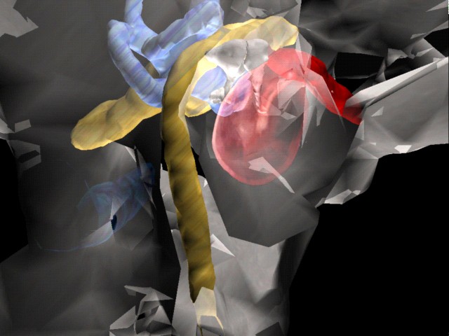 Shared VR for teaching with the
                Virtual Temporal Bone