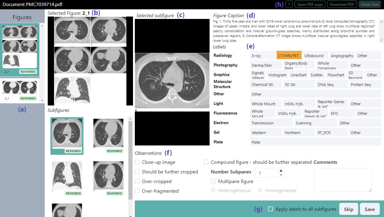 ANIMO: Annotation of Biomed Image Modalities