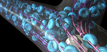Tracking cancer cells through arterial flow