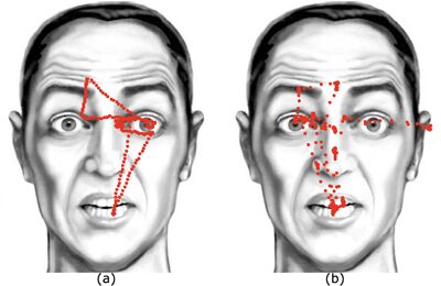 Automatic Analysis of Eye Tracking Data for Medical Diagnosis