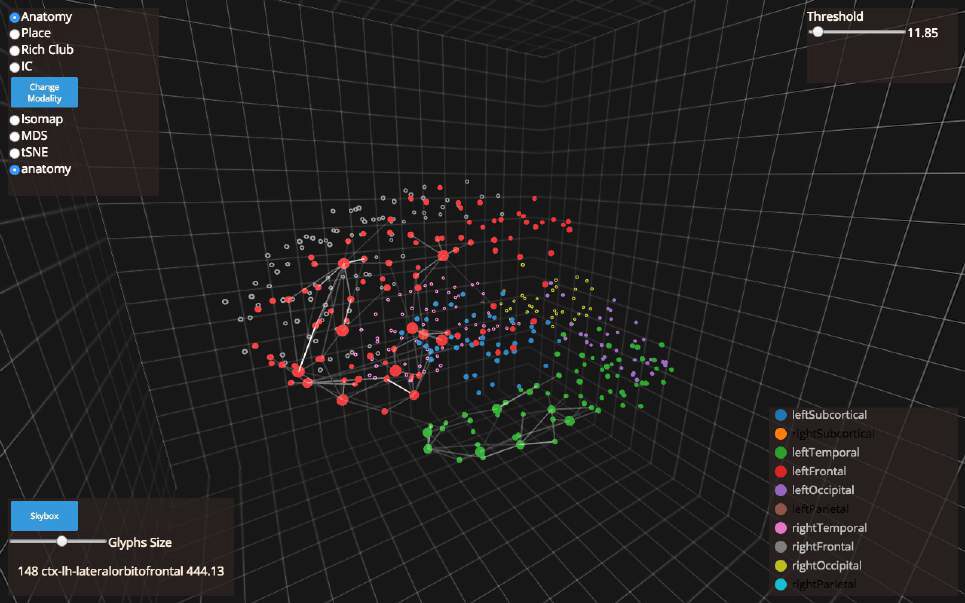 Intrinsic Geometry Visualization for the Interactive Analysis of Brain Connectivity Patterns