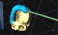 Pre-surgical Cranial Implant Design using the PARIS™ Prototype