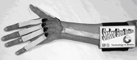 Measuring Finger Flexion and Activity Trends over a 25 Hour Period using a Low Cost Wireless Device