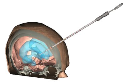 Open Surgery Training Simulator Using Haptics and Augmented Reality Technologies