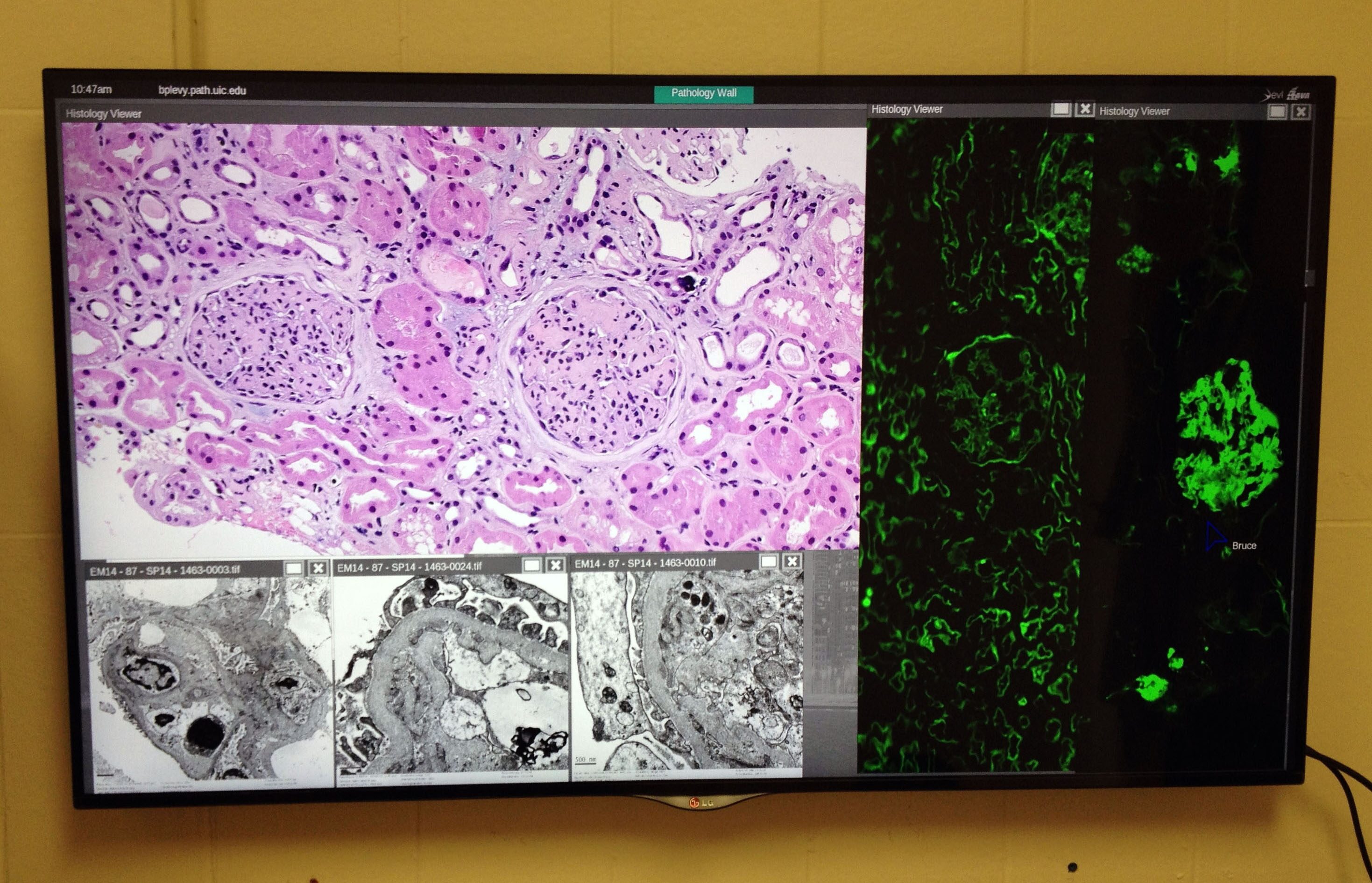 UIC Pathology uses EVL software to expand on ‘what you see is what you get’