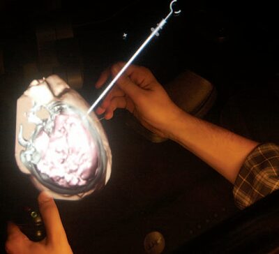 Virtual Reality in Neurosurgical Education: Part-task Ventriculostomy Simulation with Dynamic Visual and Haptic Feedback
