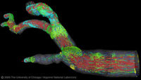 Arterial-tree Simulation