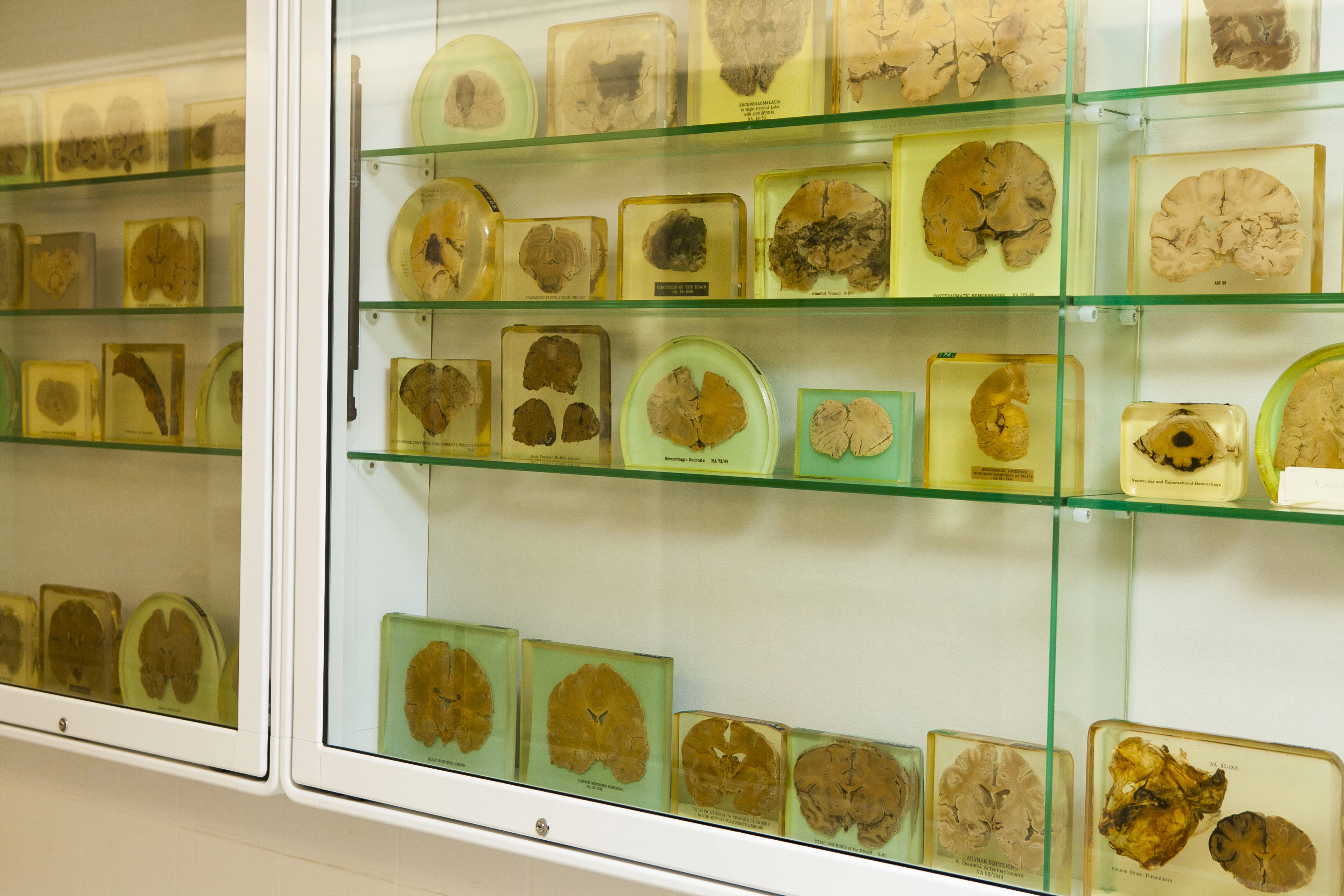 The Percival Bailey Brain Collection, located in UIC&rsquo;s Neuropsychiatric Institute.